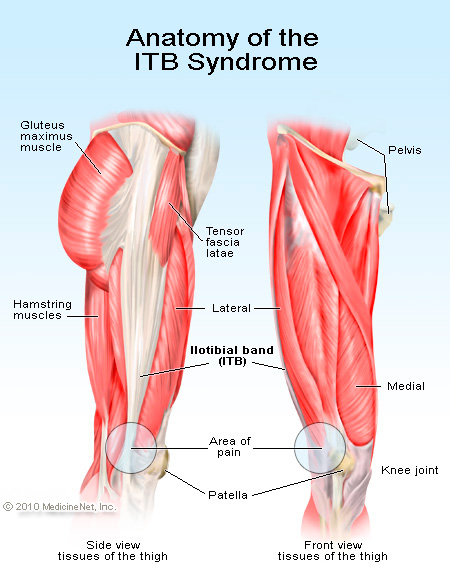 Illustration of the area of selective Iliotibial band release